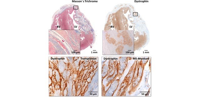 Sections of guinea pig heart tissue