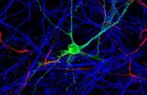 ZMNH Institut für Neuroimmunologie und Multiple Sklerose