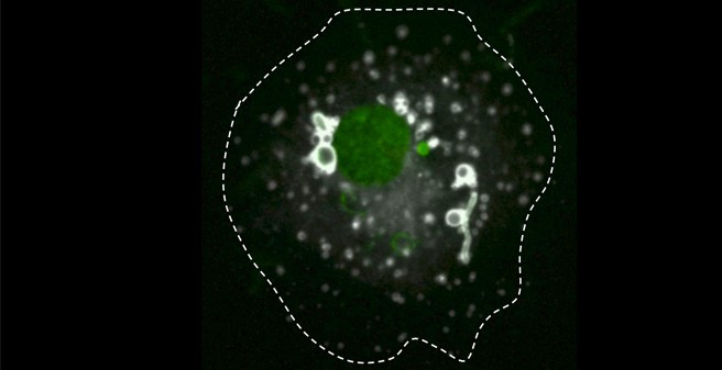 Image Borrelia burgdorferi