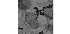 MALDI-TOF mass spectrometry