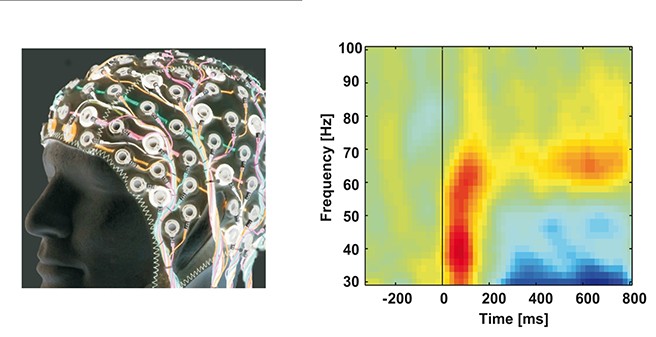 Research Group "Cognitive and Clinical Neurophysiology"