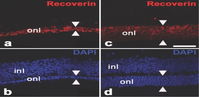 Recoverin