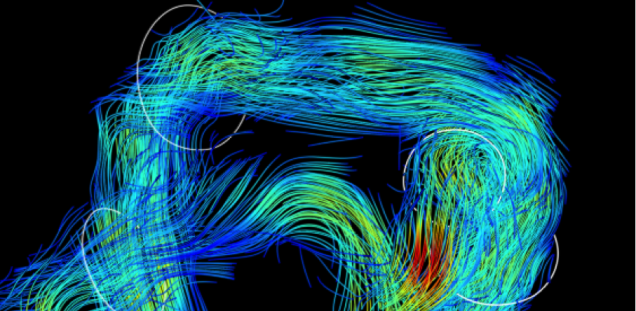  3. Beispiel einer DUS-gegateten 4D Fluss-MRT der fetalen Aorta in der 34. Schwangerschaftswoche bei 1,5T.