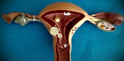 Uterusmodel