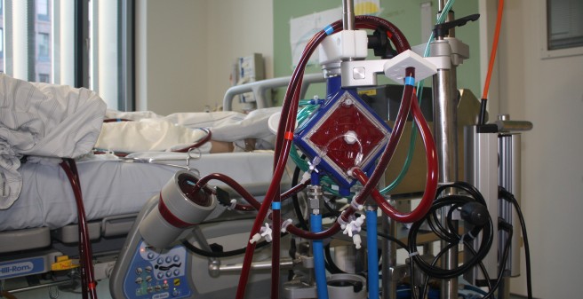 ECMO/ECLA