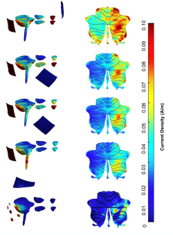 Modulation des Termornetzwerks bei Parkinson