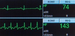 Monitoring in der ZNA