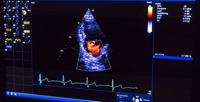 Kardiovaskuläre Bildgebung